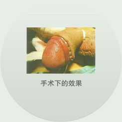 手术下的效果